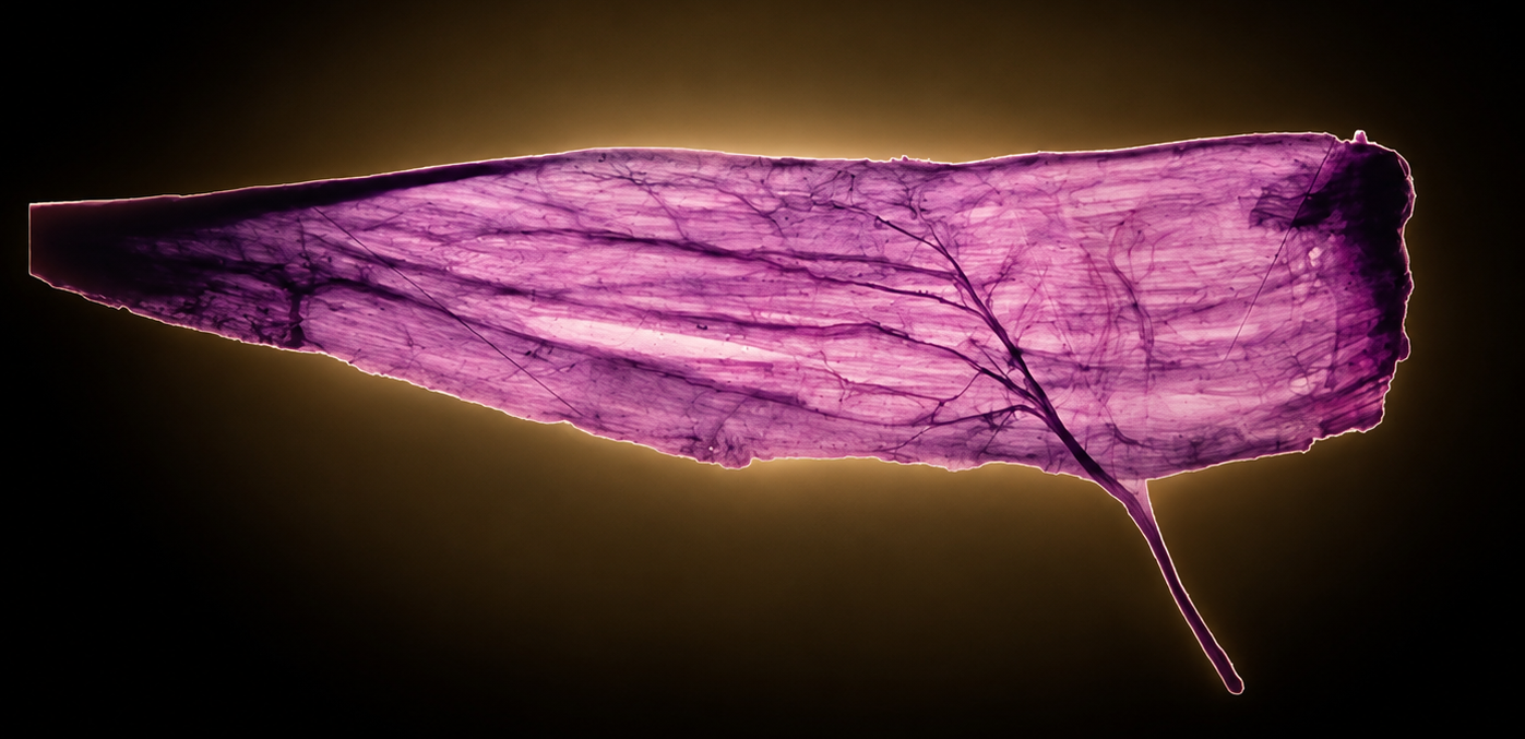 Anatomical specimen illustrating morphology-derived clinical interpretation